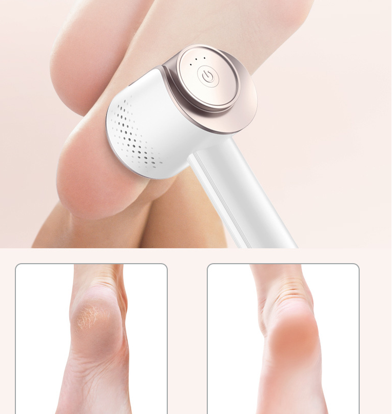 Electric Foot Grinder To Remove Dead Skin