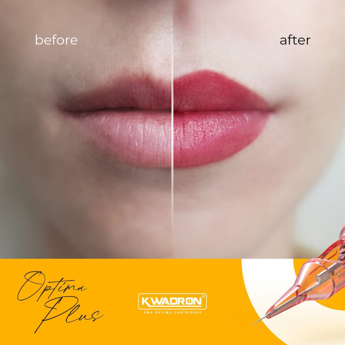 Kwadron PMU Optima Plus Cartridges  Round Liners