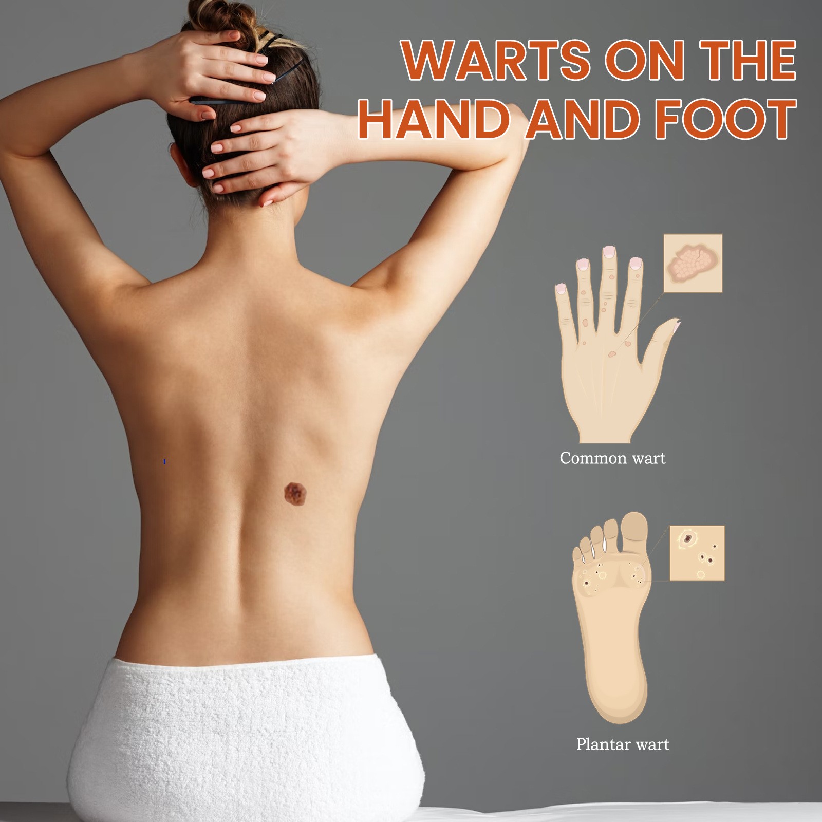 Cleansing Skin Wart Fading Black Mole Corns Mild And Smooth Skin Care Solution