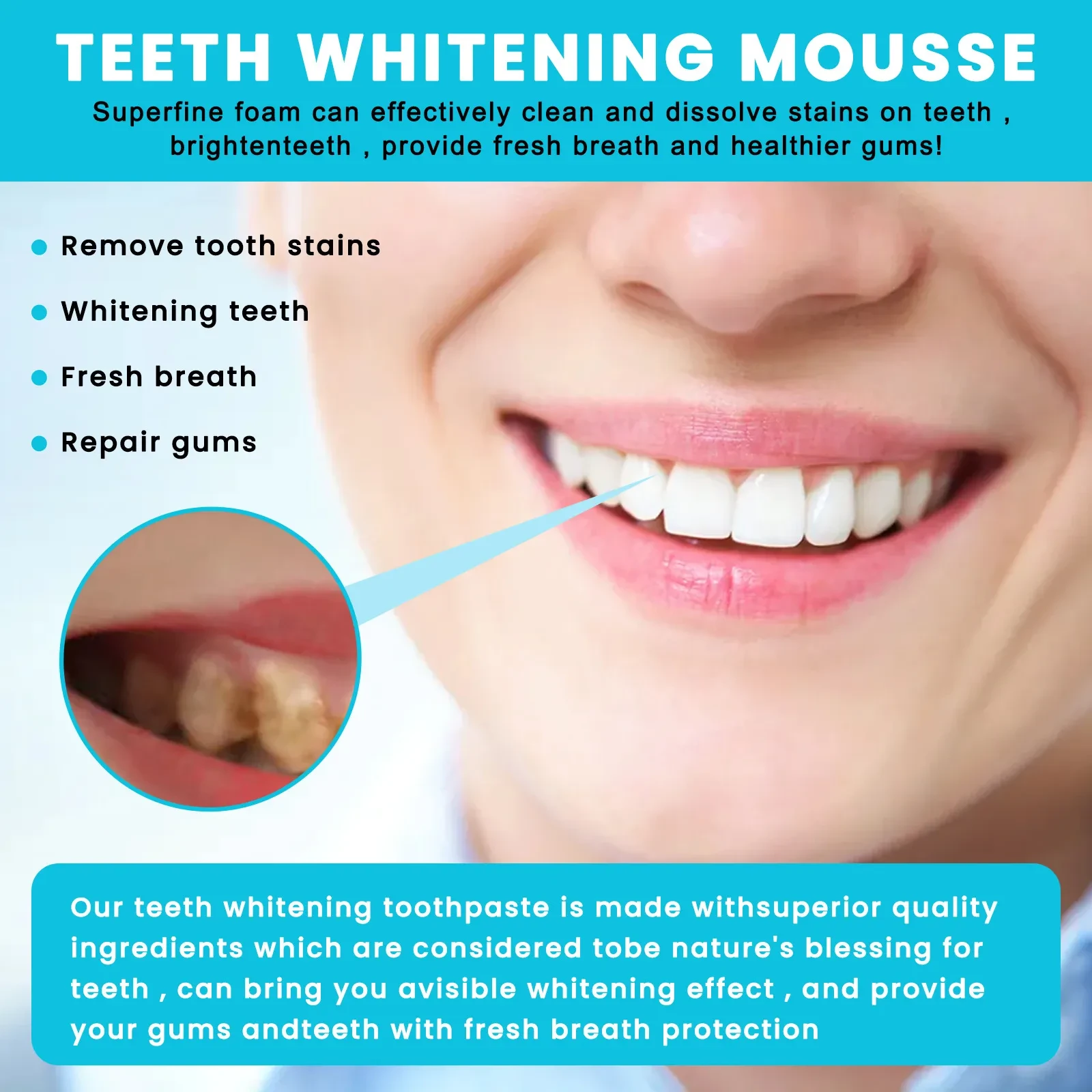 OUHOE Teeth Whitening