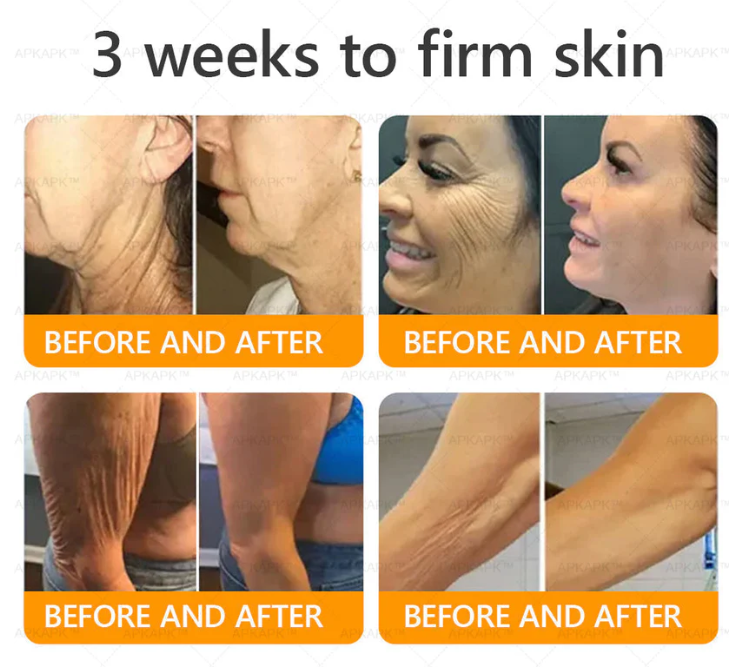 AWZLOVE Bee Venom Comprehensive Cream