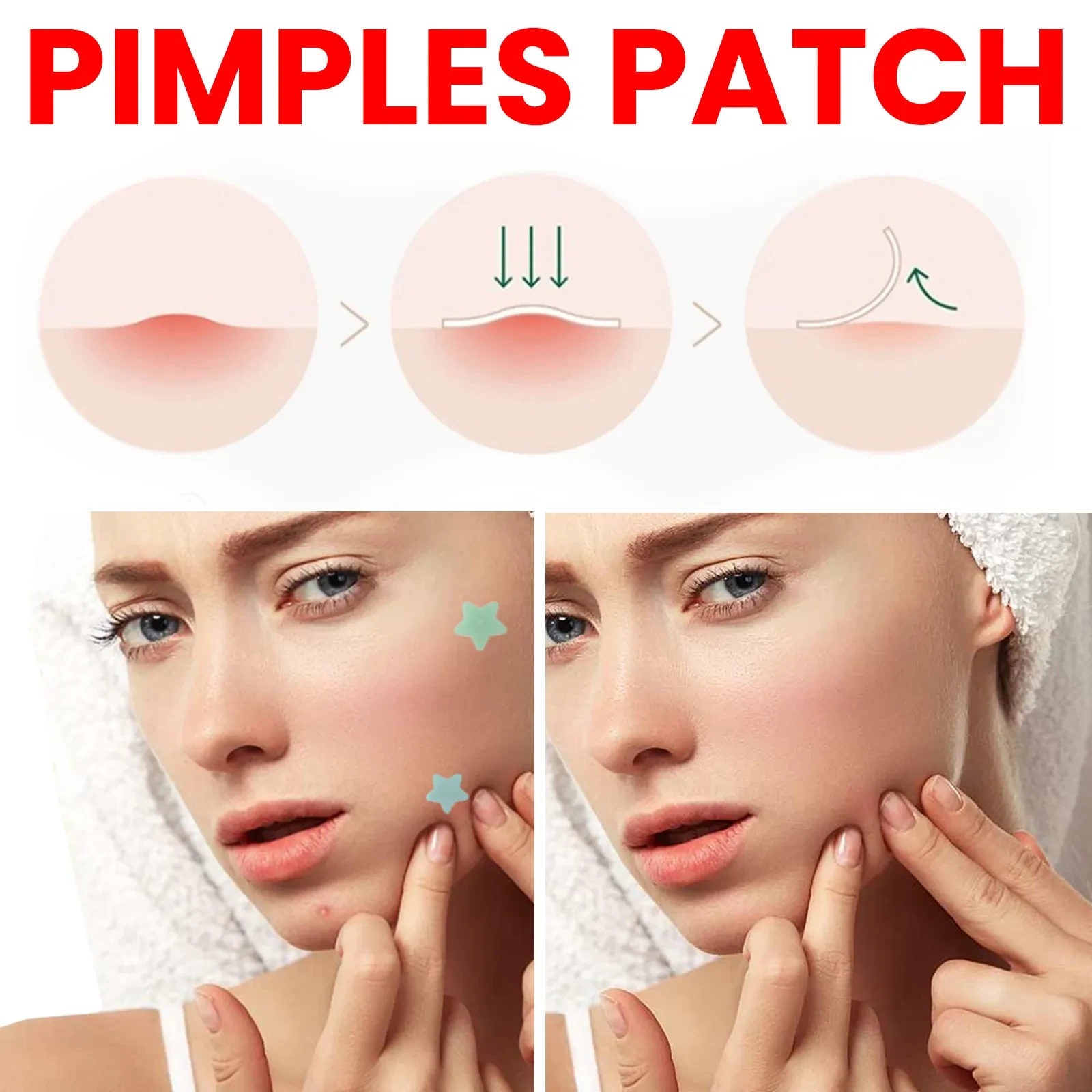 Pimple Patch