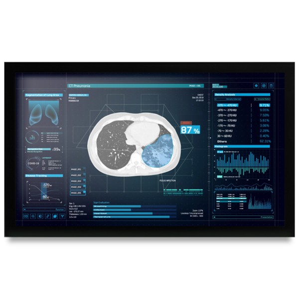 Onyx MEDDP-627HPN 27" Medical Touch Display