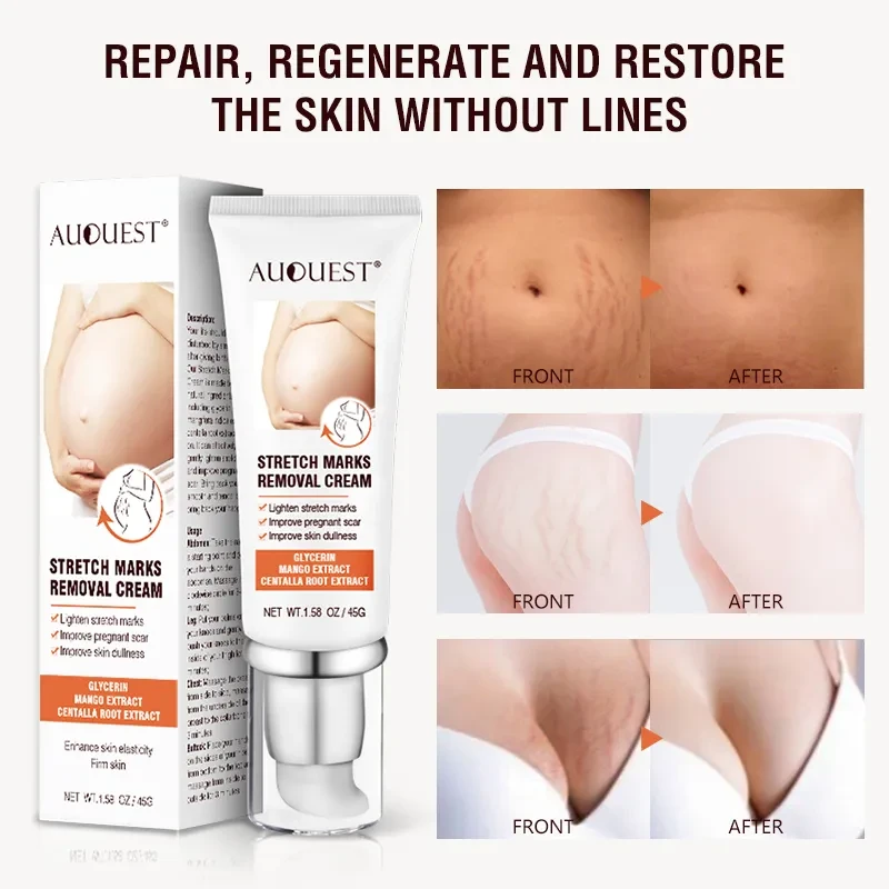 AUOUST Stretch Marks Removal Cram