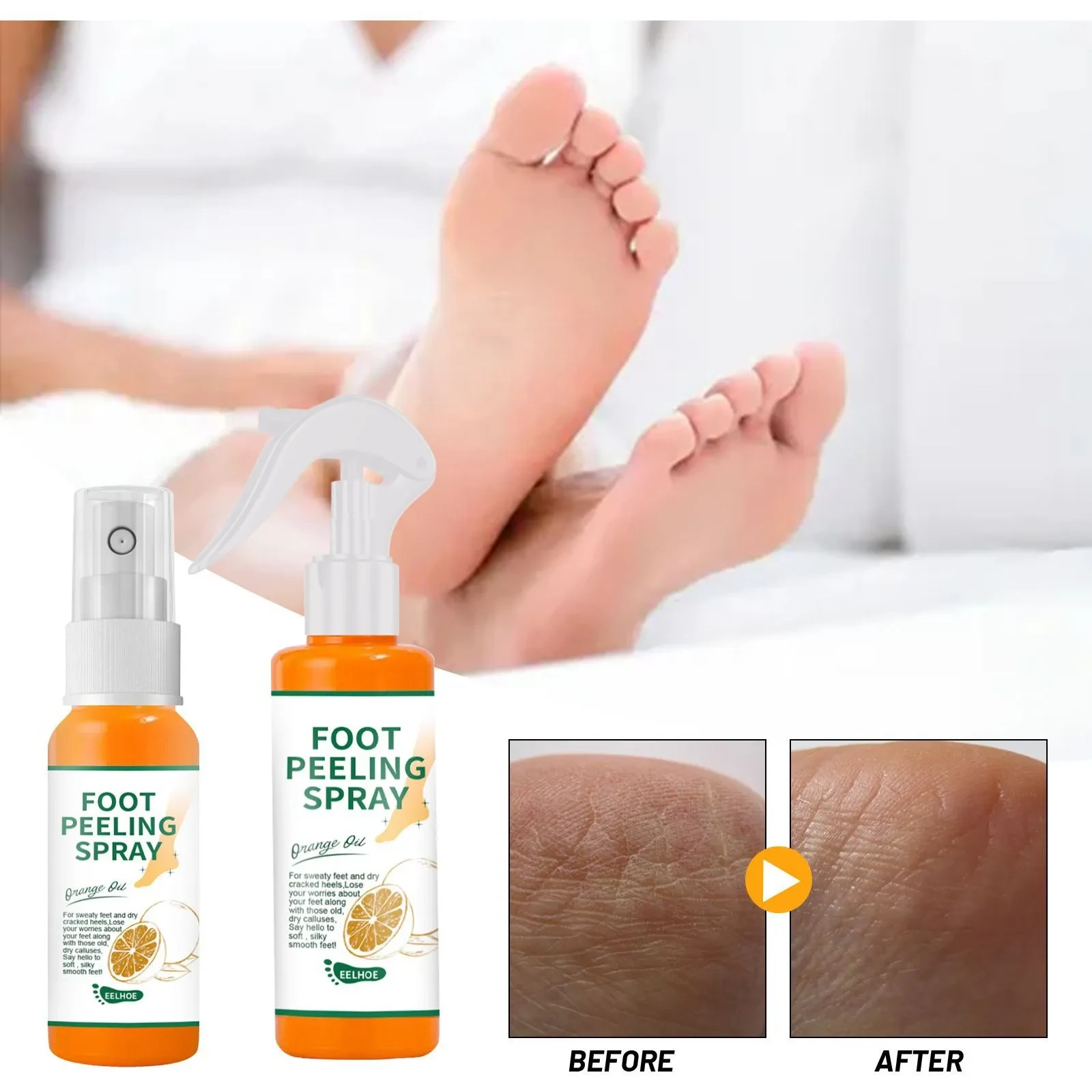 Foot Peeling Spray with Orange Oil