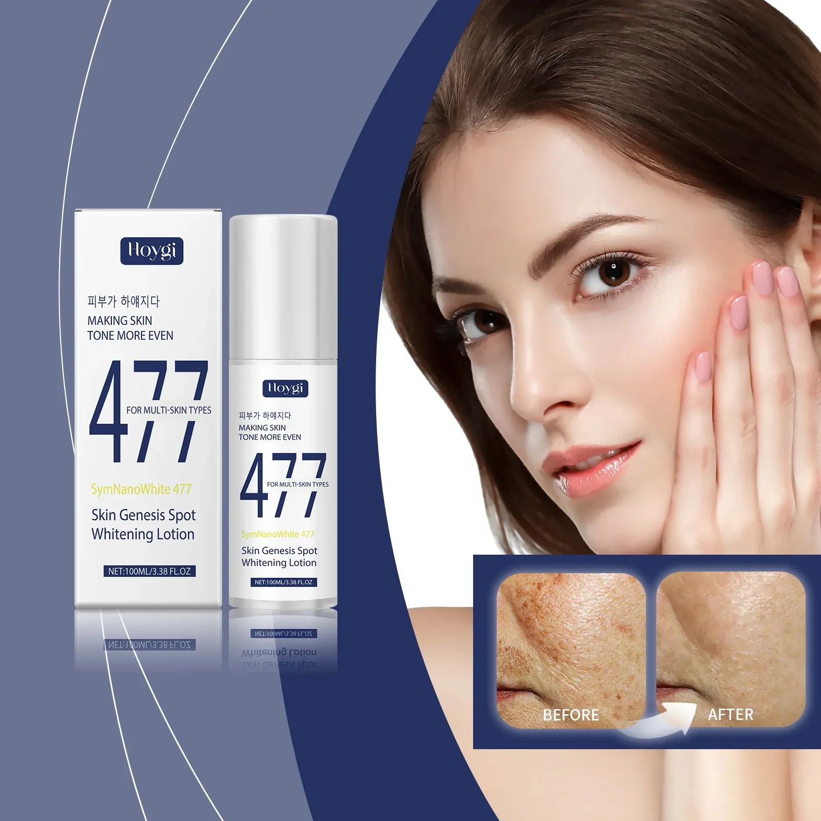 Hoygi Skin Genesis Spot Whitening Lotion