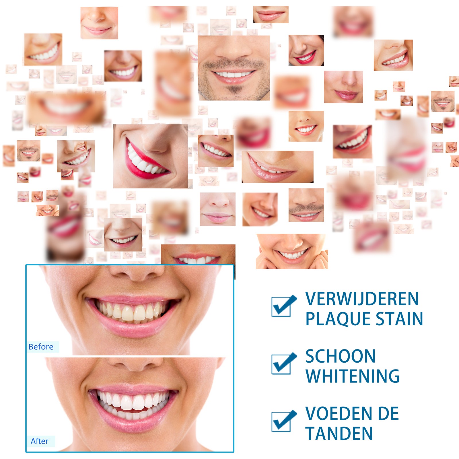 Jaysuing Teeth Whitening Tooth Brush Instant Brightening Solution