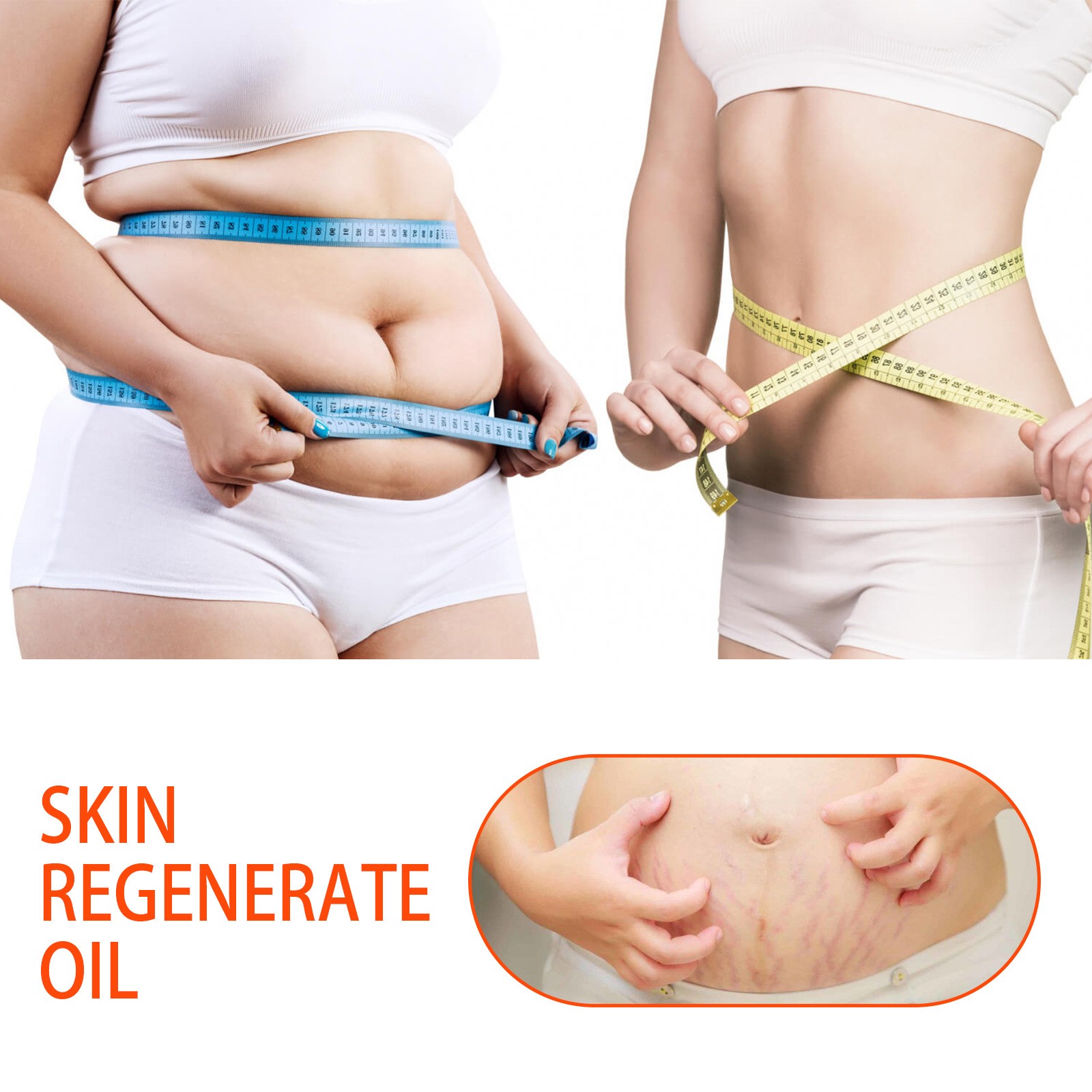 Jaysuing Skin Regenerate Oil Stretch Mark & Scar Treatment