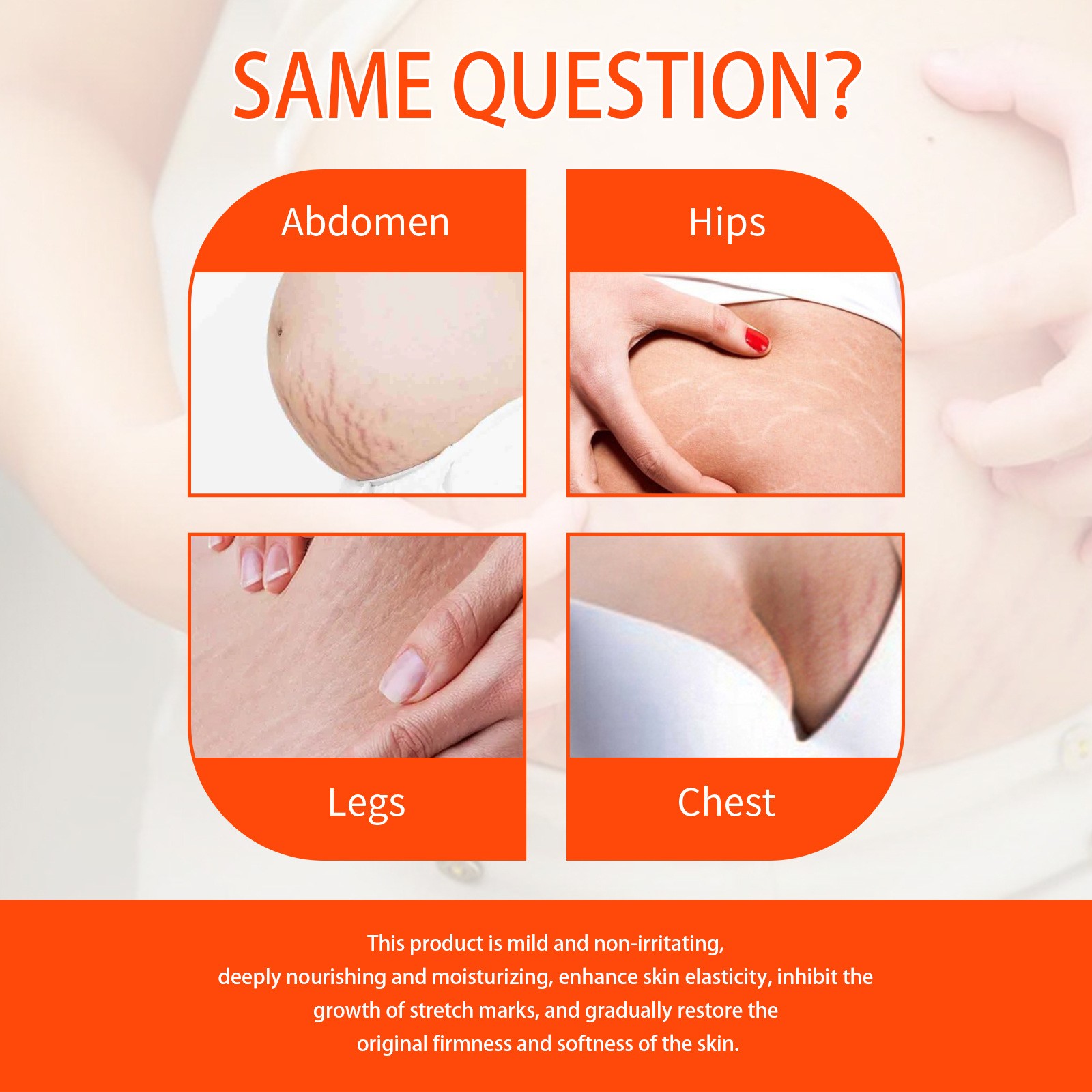 Jaysuing Skin Regenerate Oil Stretch Mark & Scar Treatment