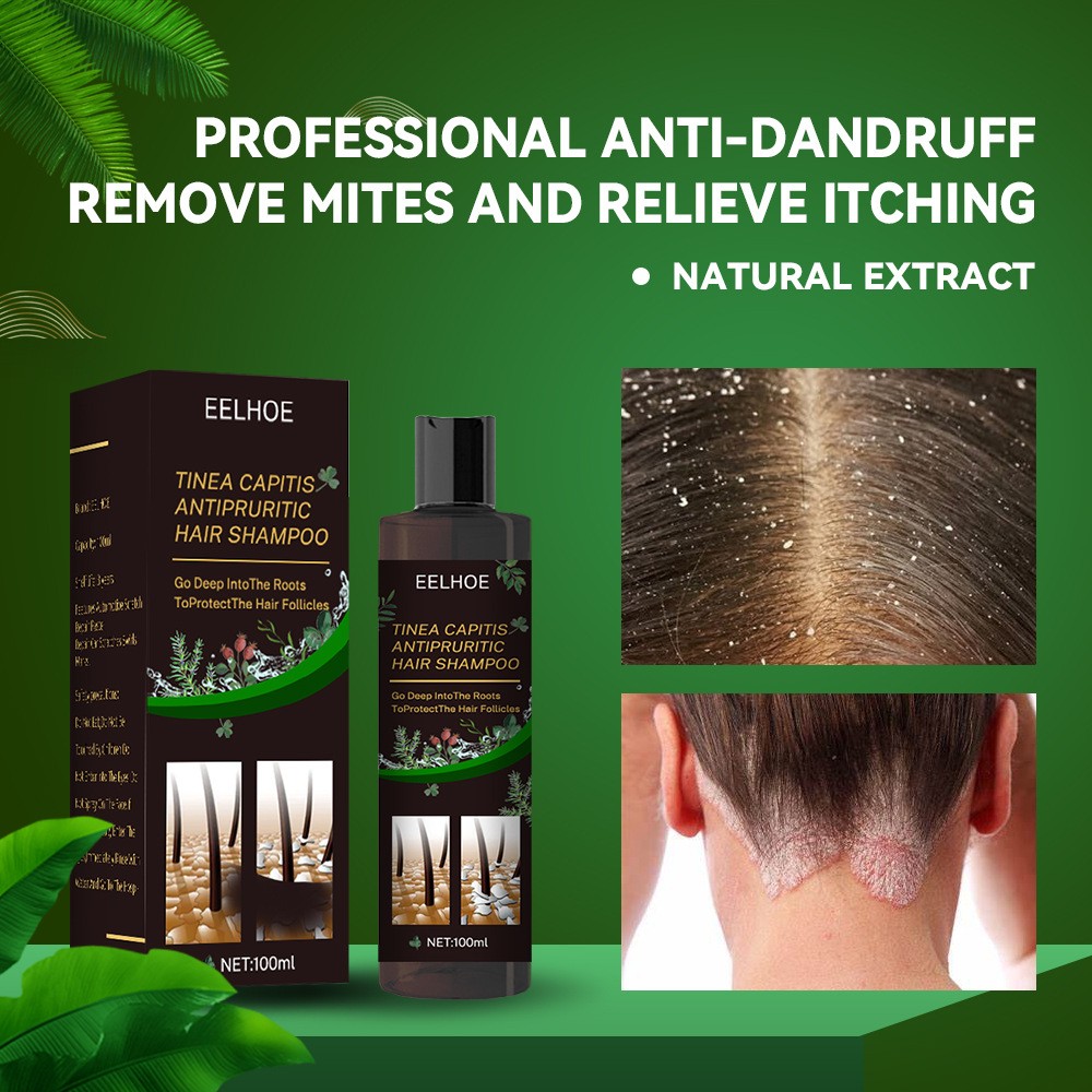 EELHOE Plant Formula Antipruritic Hair Shampoo  Dandruff Control & Hair Follicle Protection