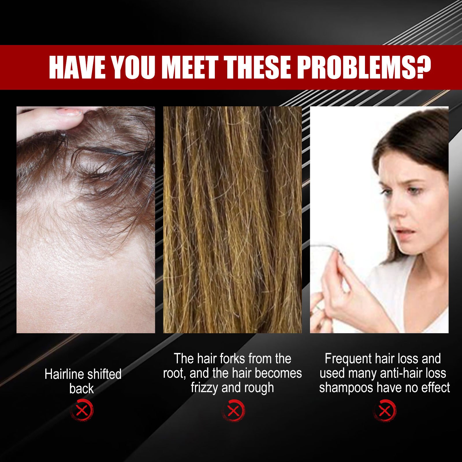 Eelhoe Organic Black Rice Water Spray - 30ml