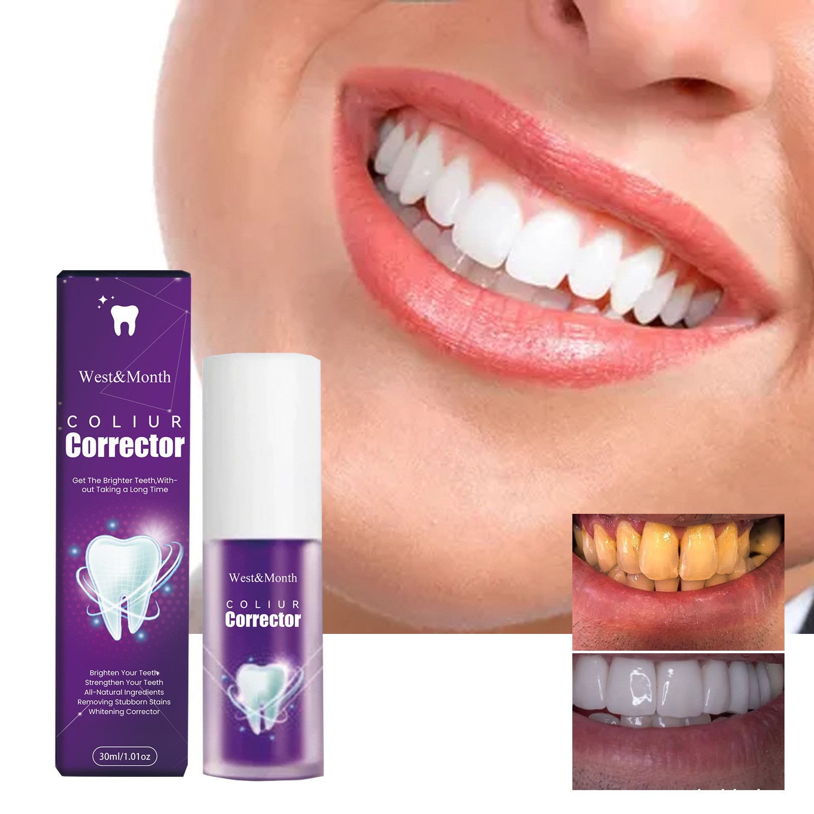 West&Month Coliur Teeth Whitener Corrector Brighten Your Smile in Minutes