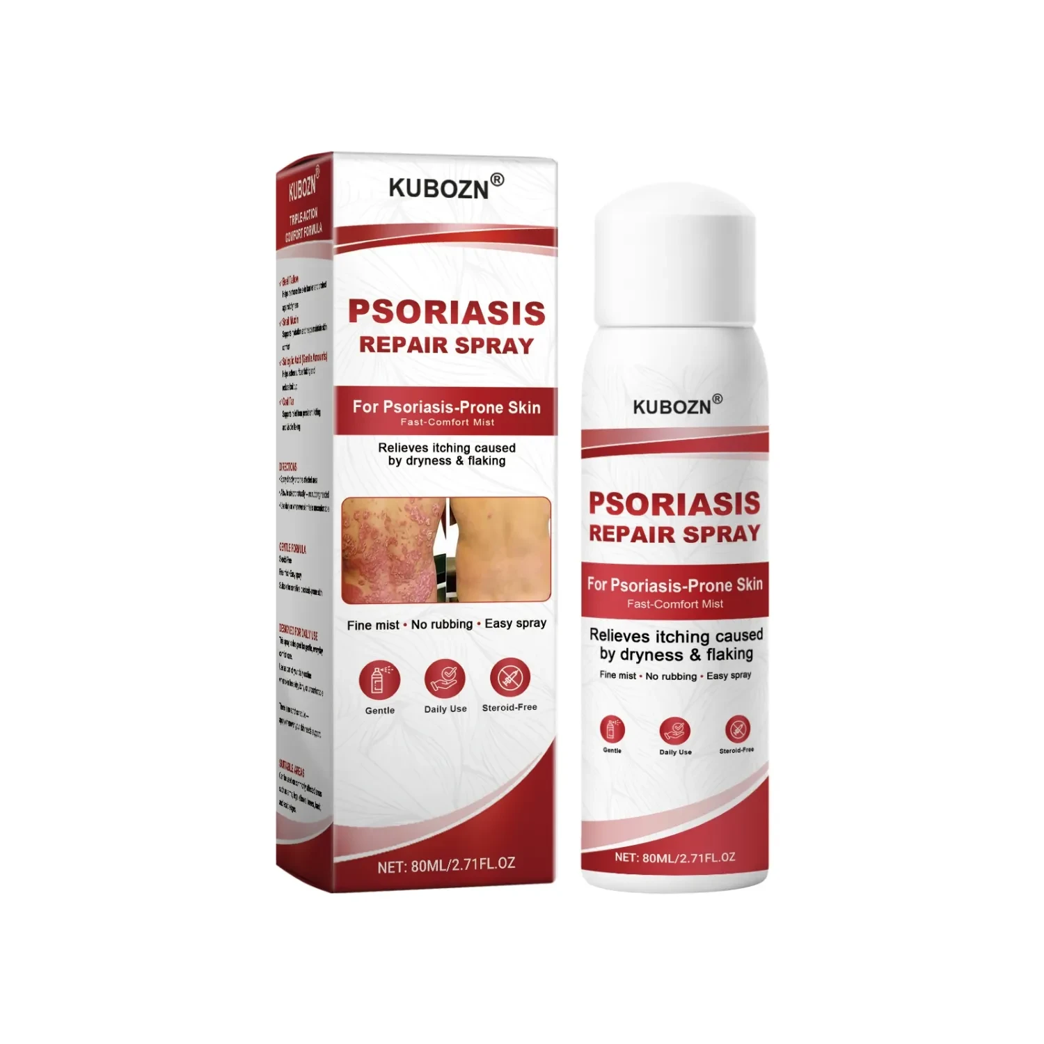 KuboZN Psoriasis Repair Spray