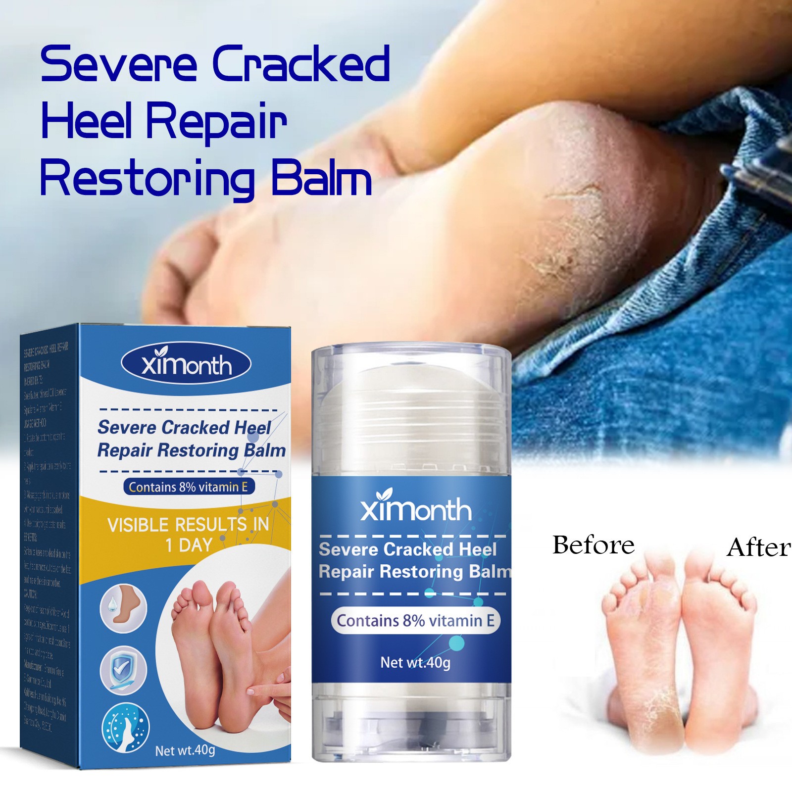 Anti Crack Heel Nourish Cream