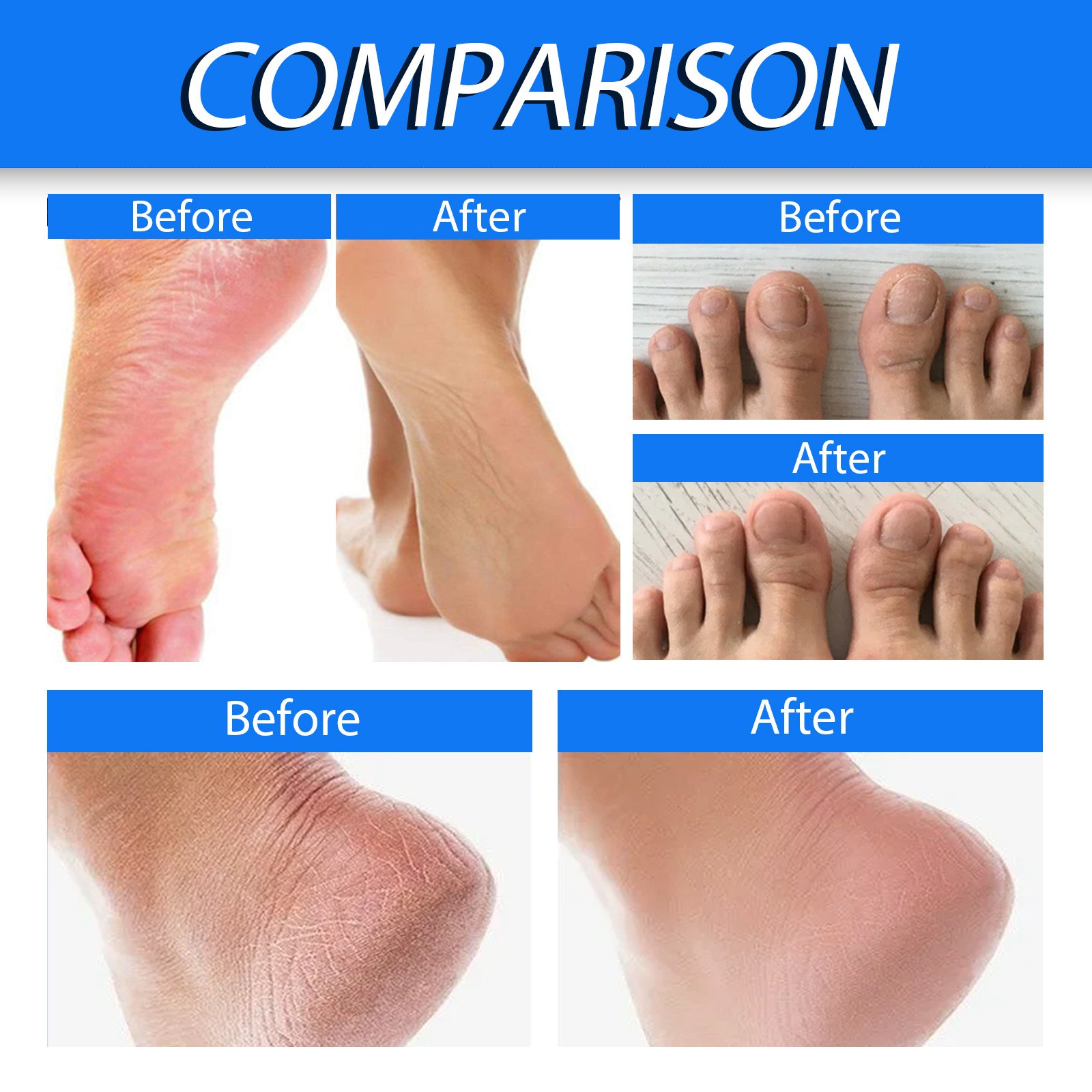 Anti Crack Heel Nourish Cream