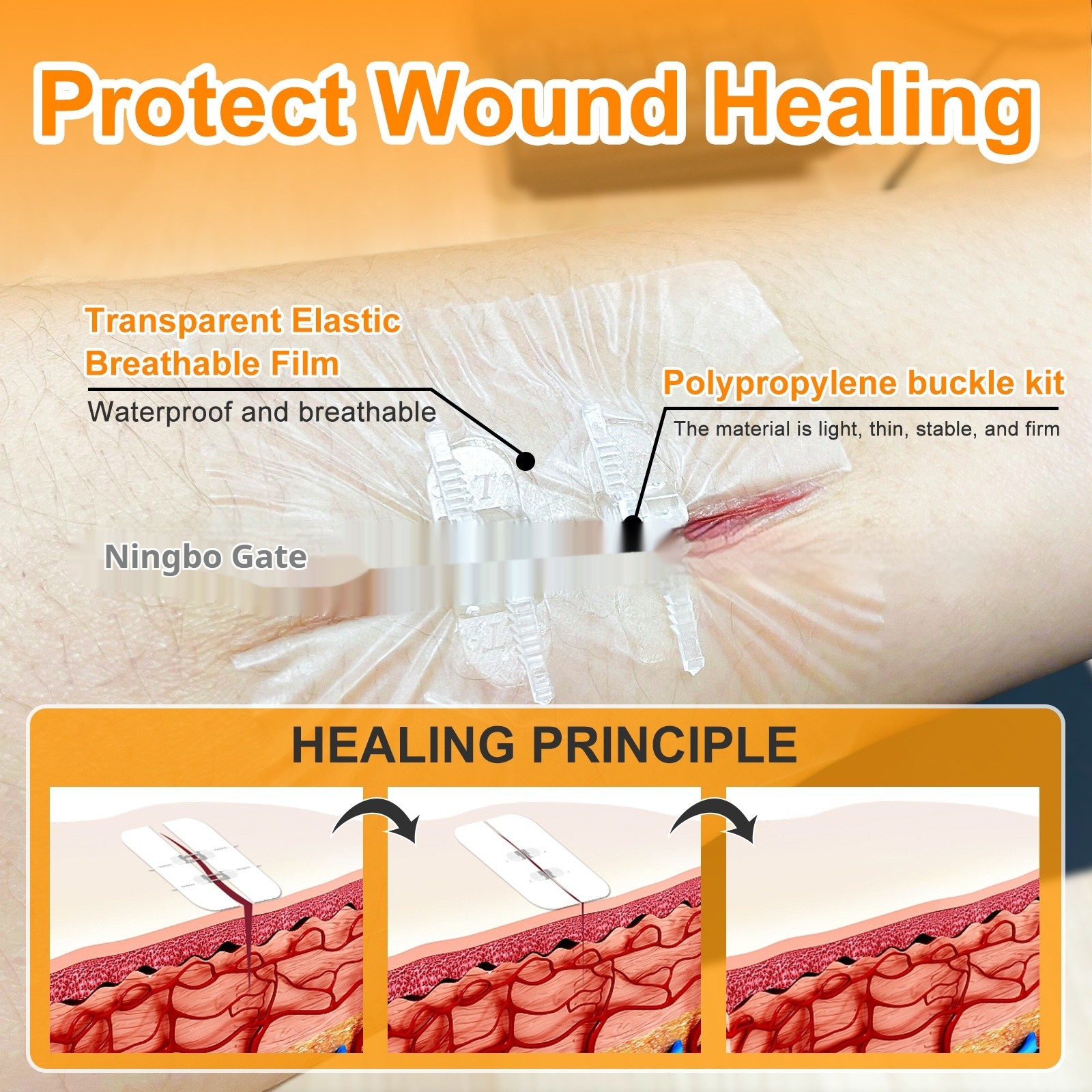 Wound Closure Device