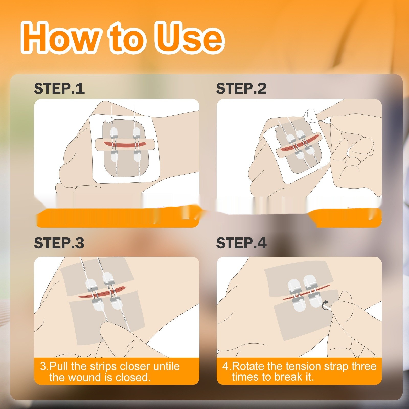 Wound Closure Device