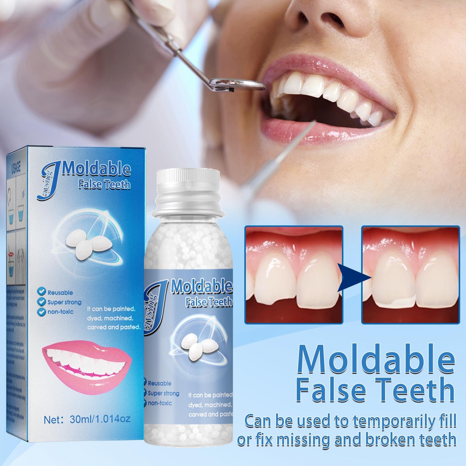 Moldable Broken Teeth Gaps Filling