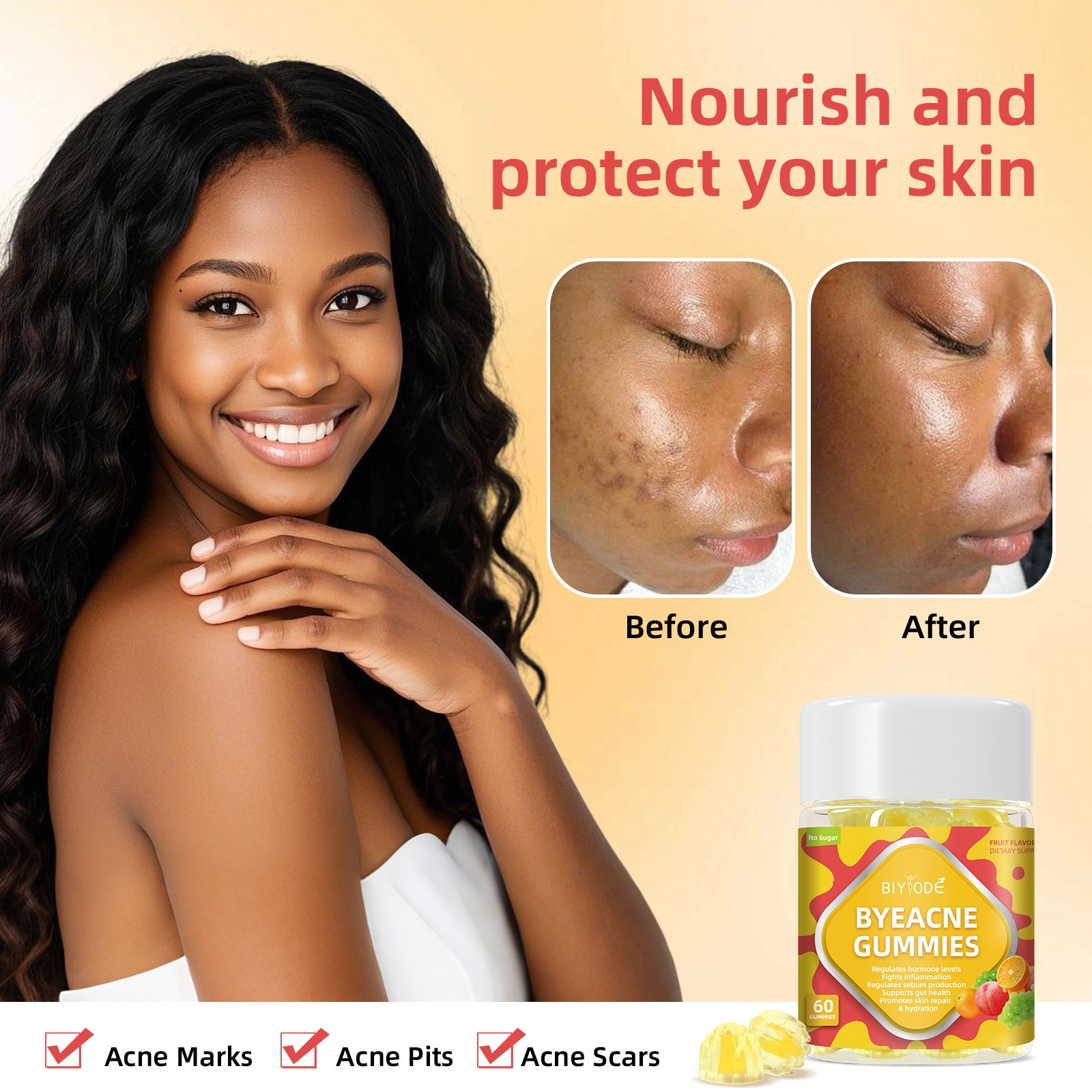 ByeAcne Gummies  Sugar-Free Daily Skin Support from Within