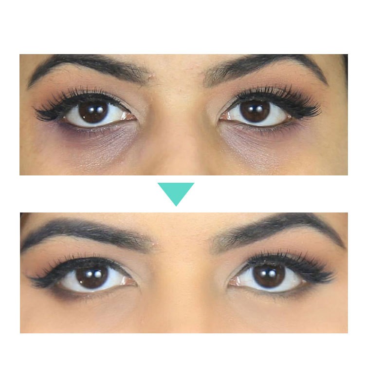 AnYi Beauty Eye Cream  Target Dark Circles, Puffiness, and Fine Lines