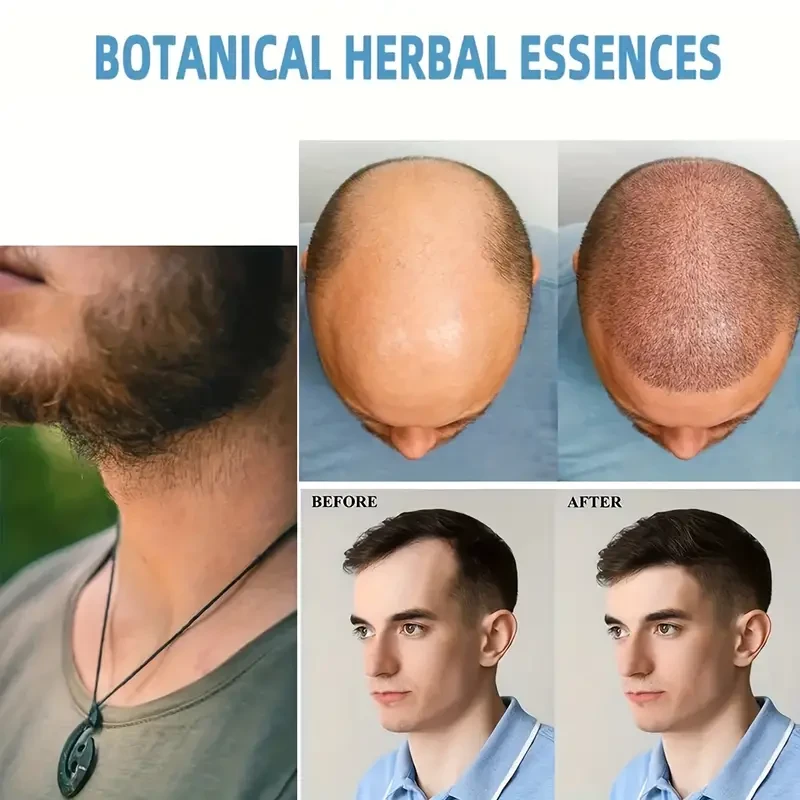 Biotin Keratin Hair Renew Cream - Essential Hair Care Oil for Women and Men, Penetrates from Root to Tip for Healthy Hair