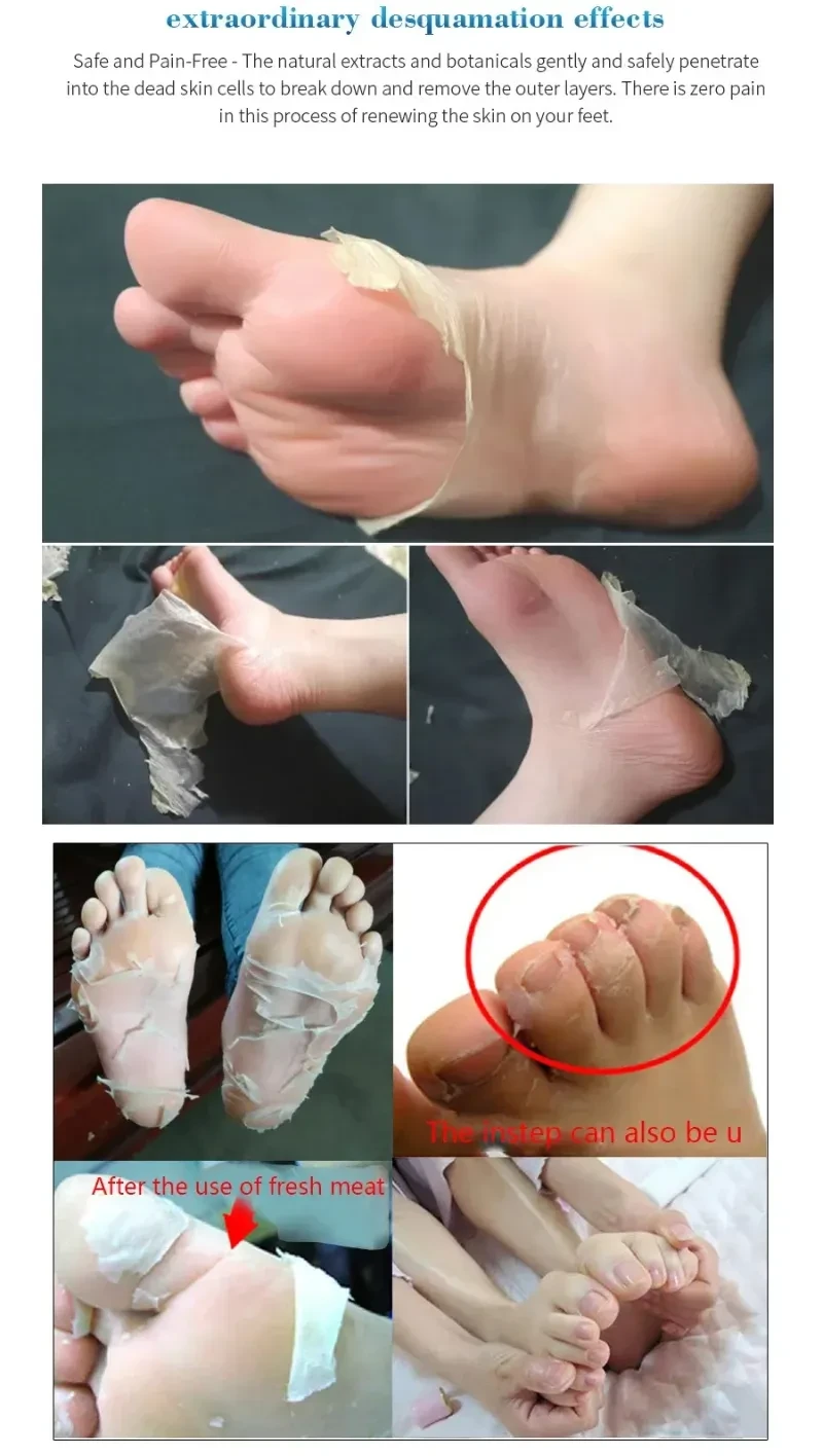 Whitening Heels Feet Peeling Anti Cracked Foot Skin Care