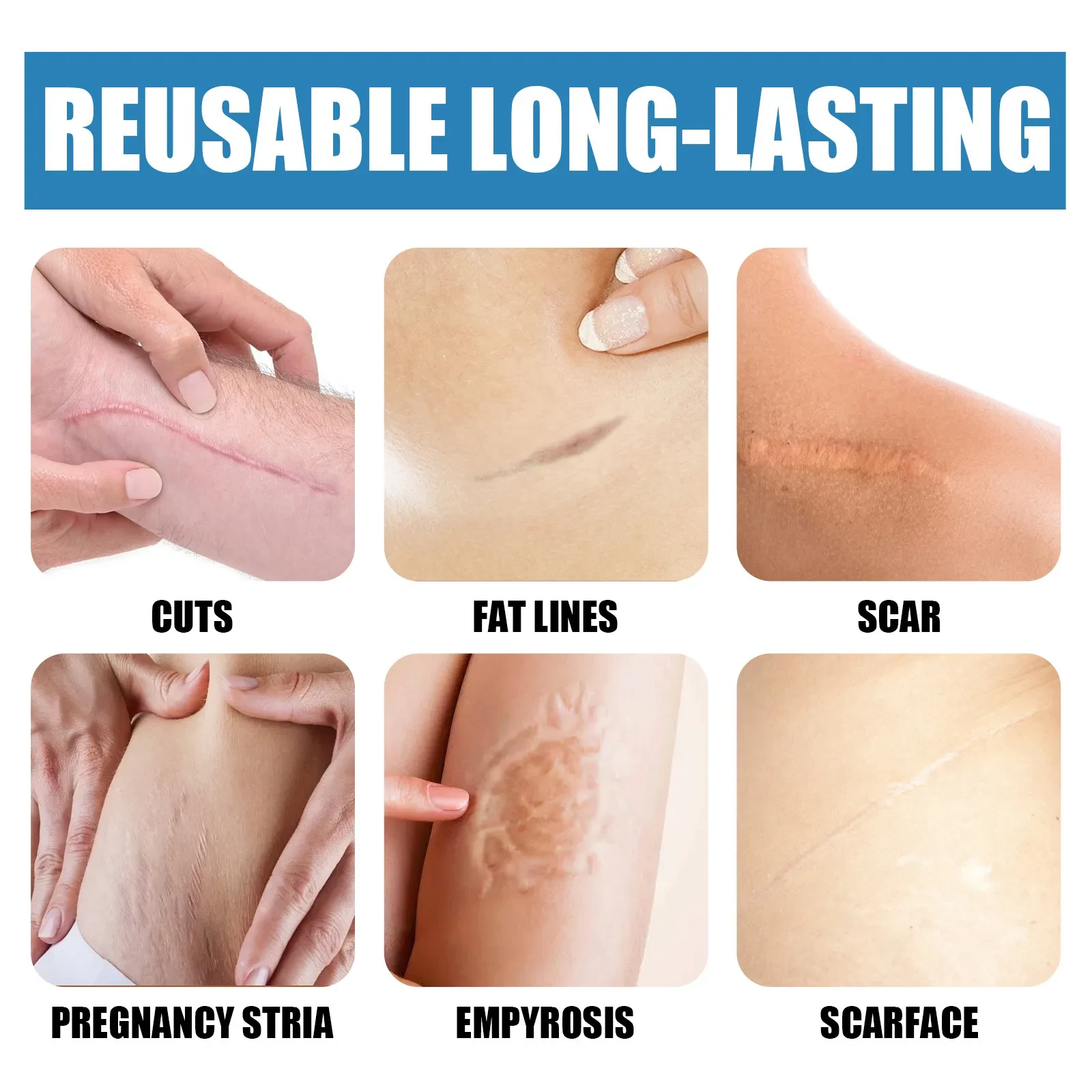 Light Scar Pen Gentle Fade Repair Skin Scar