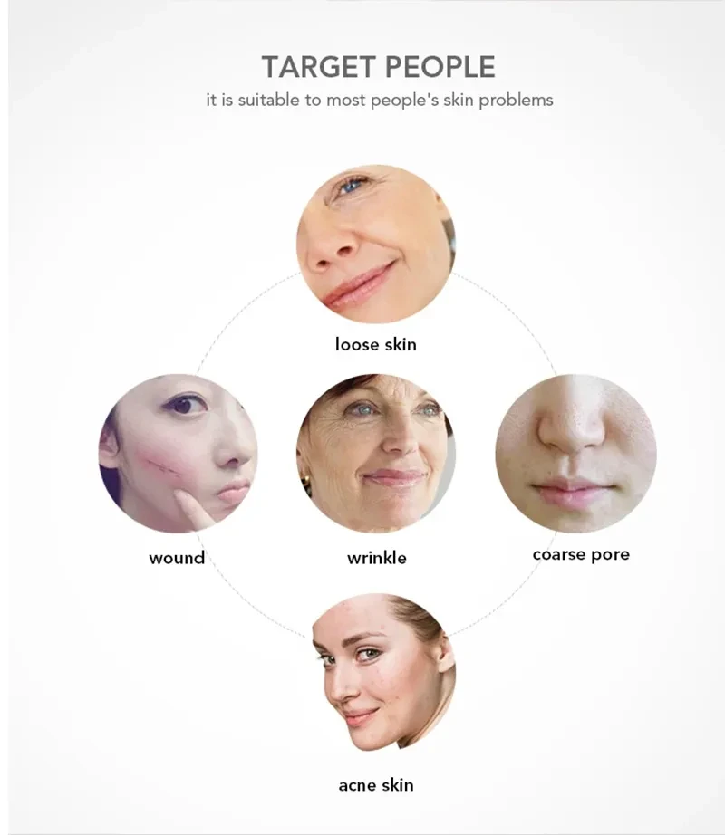 High Frequency Electrotherapy Electrode Lamp Acne