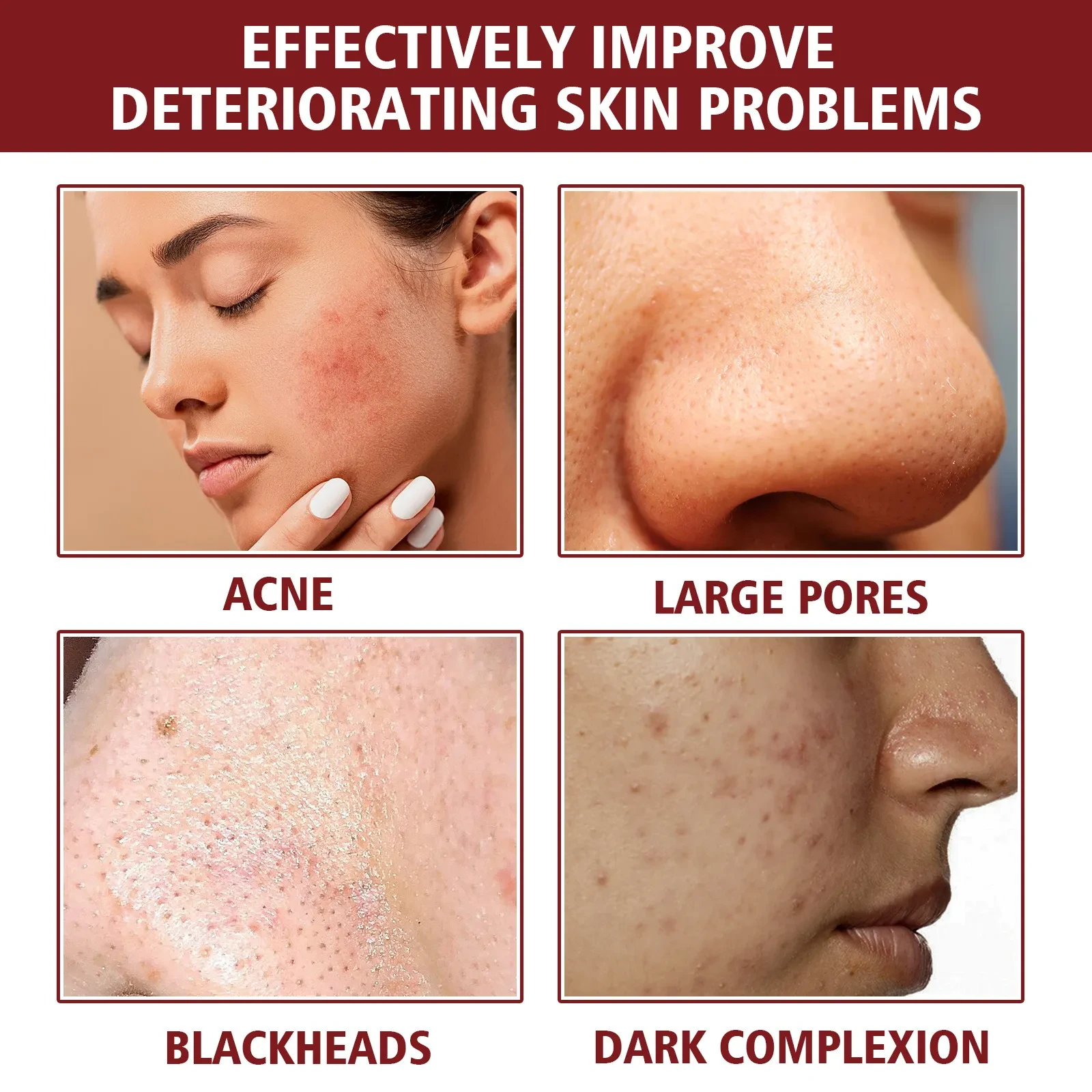 Tender Pores Moisturizing And Softening Cutin Skin Fading Spots