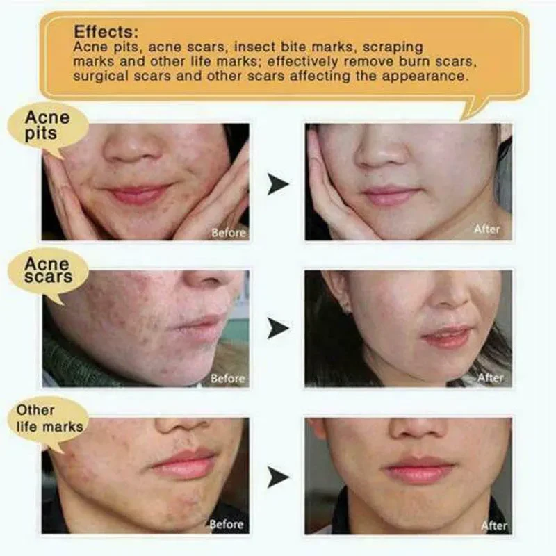 Collagen Gold Moisturizing And Firming Collagen Eye Mask