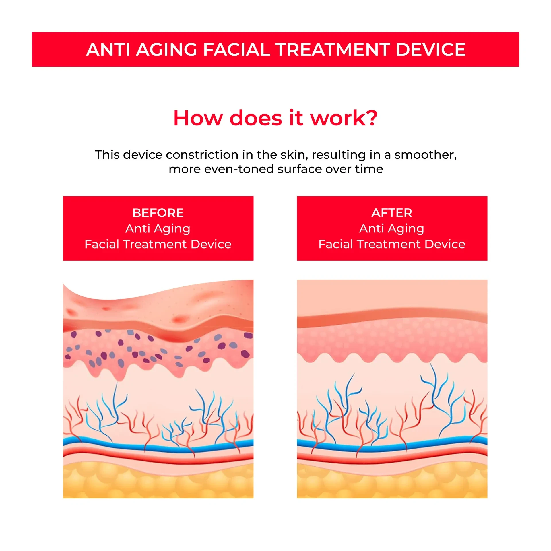EMS Skin Rejuvenation Device with Microcurrent for Pore Tightening and Skin Firming