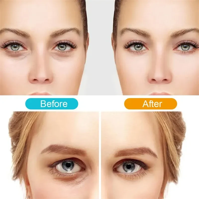 3D Eye Beauty Instrument