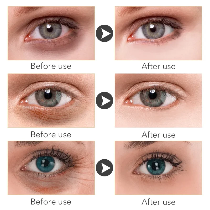 Instant Remove Eye bags Cream Anti Puffiness Gel