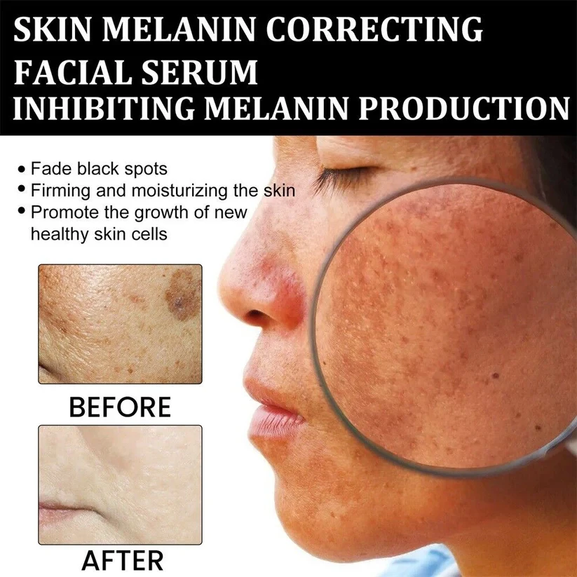 AQA Melanin Correcting Brightening Serum - Advanced Anti-Aging & Dark Spot Treatment