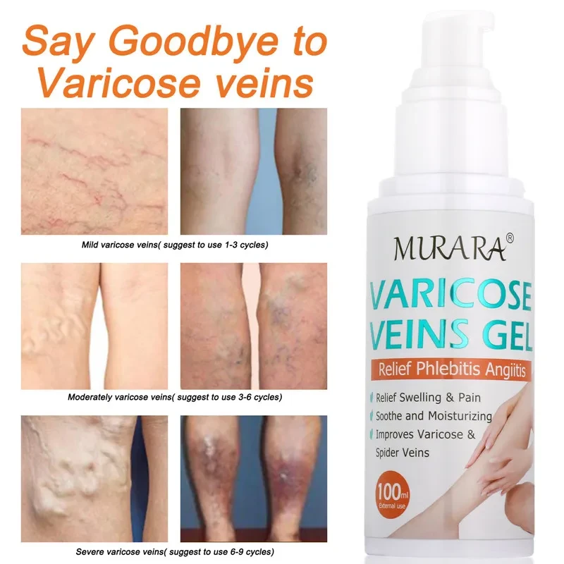 Vein Cream Gel Repair Relief Blue Vein