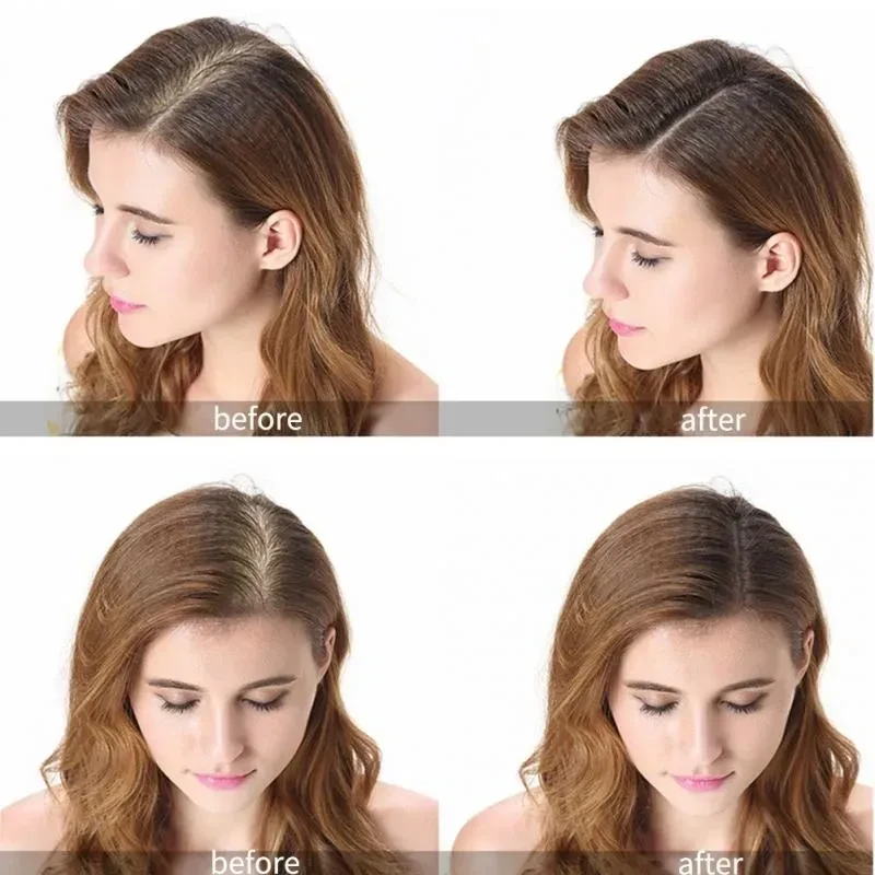 Hair Care Ginger Spray Shampoo Suit