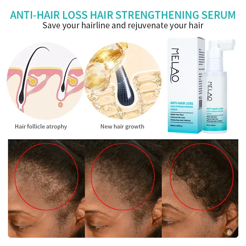 Growing Hair Growth Liquid Scalp Care