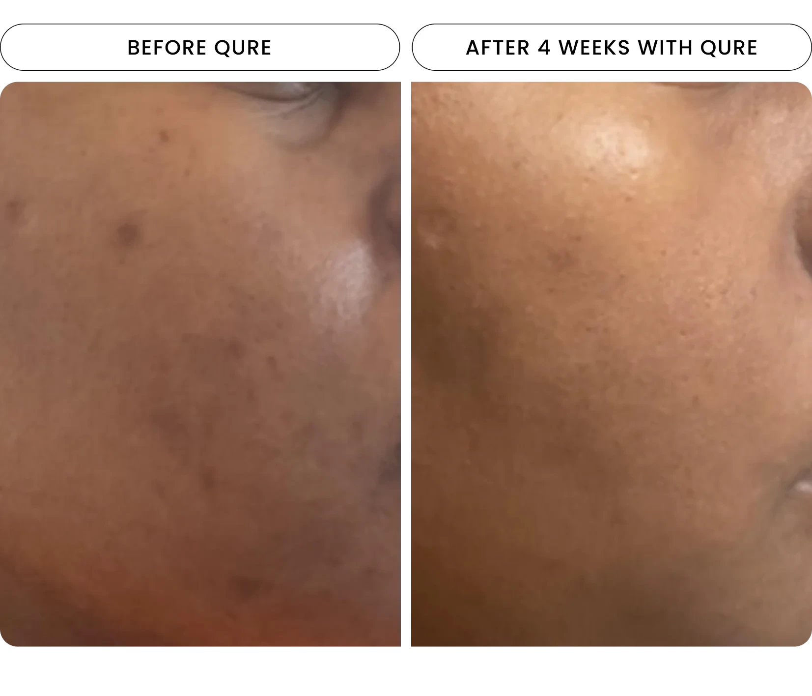 Repair & rejuvenate your skin with our Light Therapy Mask
