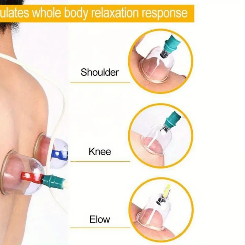 24-Piece Vacuum Cupping Set for Massage Therapy