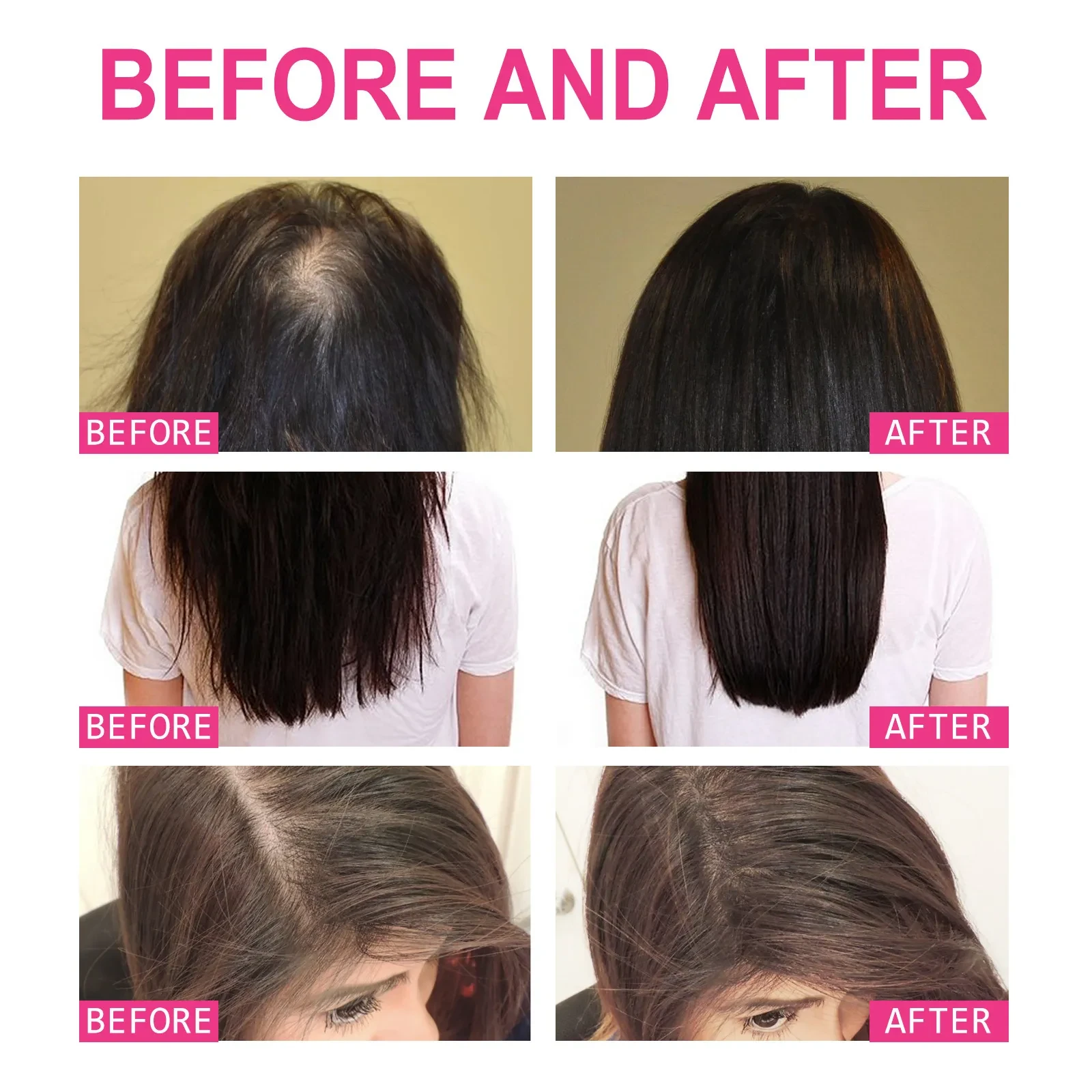 Essential Oil Moisturizing And Repairing Dry And Frizz