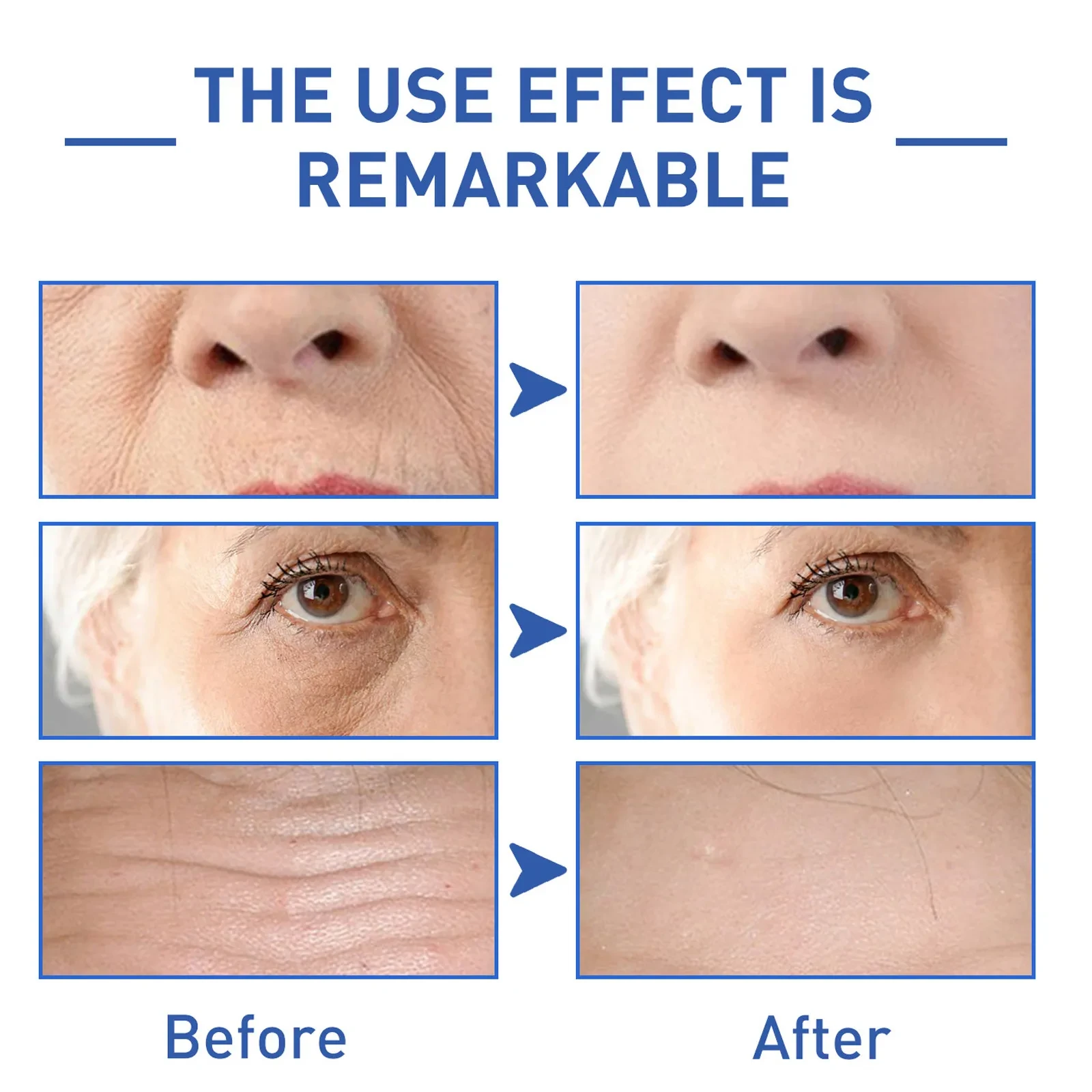 Water Light Cone Shell Peptide Anti-wrinkle