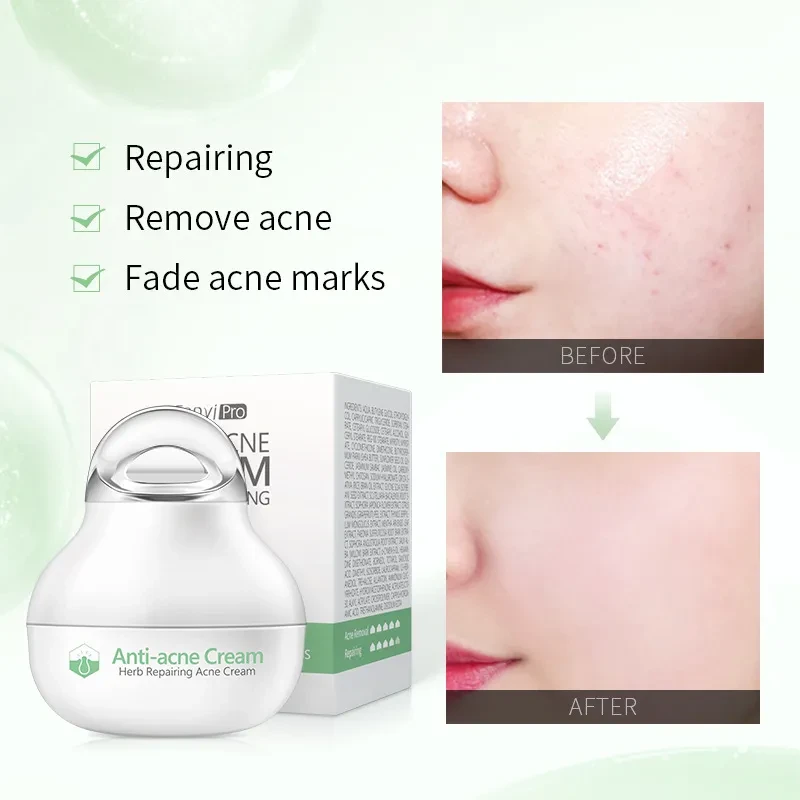 Herbal lotion Moisturizing Facial Cream