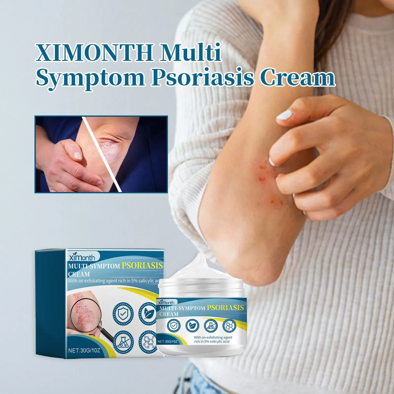 Ximonth Psoriasis Treatment Cream