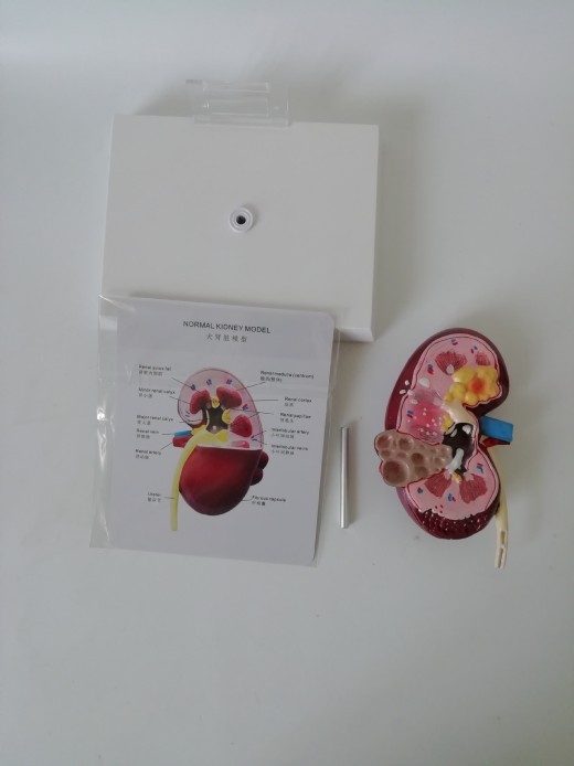 Anatomical Model Of Kidney Stone Pet Dog Lesion