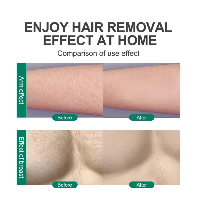 Magic Crystal Hair Eraser For Women And Men