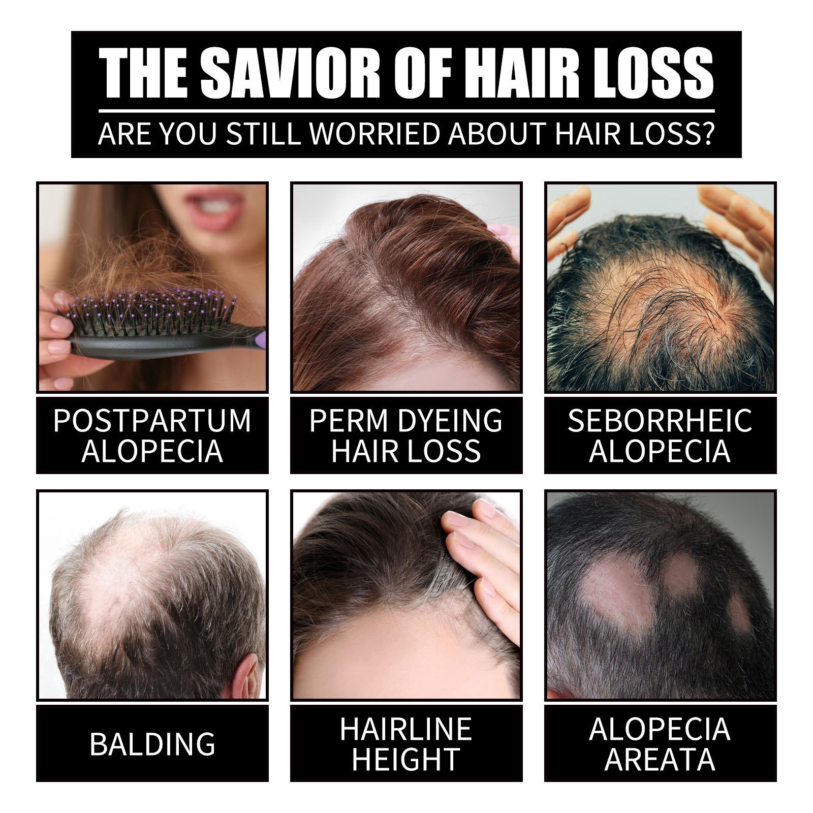 Biotin Fast Oil Hair Regrowth Serum - Anti-Hair Loss Treatment for Hair Thinning