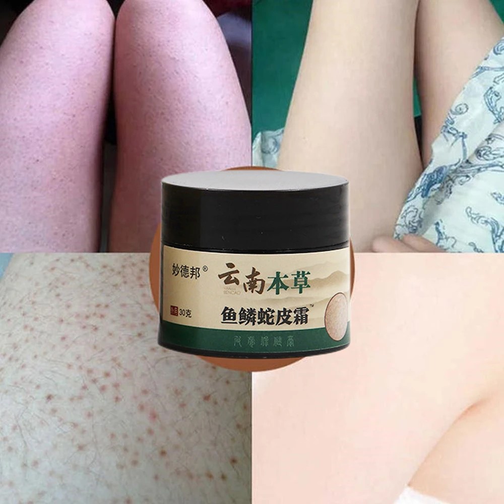 Chicken Skin Repair Cream - Keratosis Pilaris Treatment and Pore Smoothing