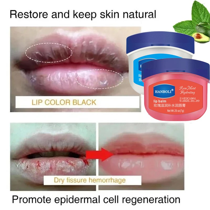 Remove Dark Lip Balm - Lightening & Moisturizing Korean Lip Care