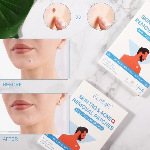 New Skin Tag Remover Patches Skin Tag Remover Pads Covers Conceals Skin Tags Mole Wart Removal Patches Fast Deliver