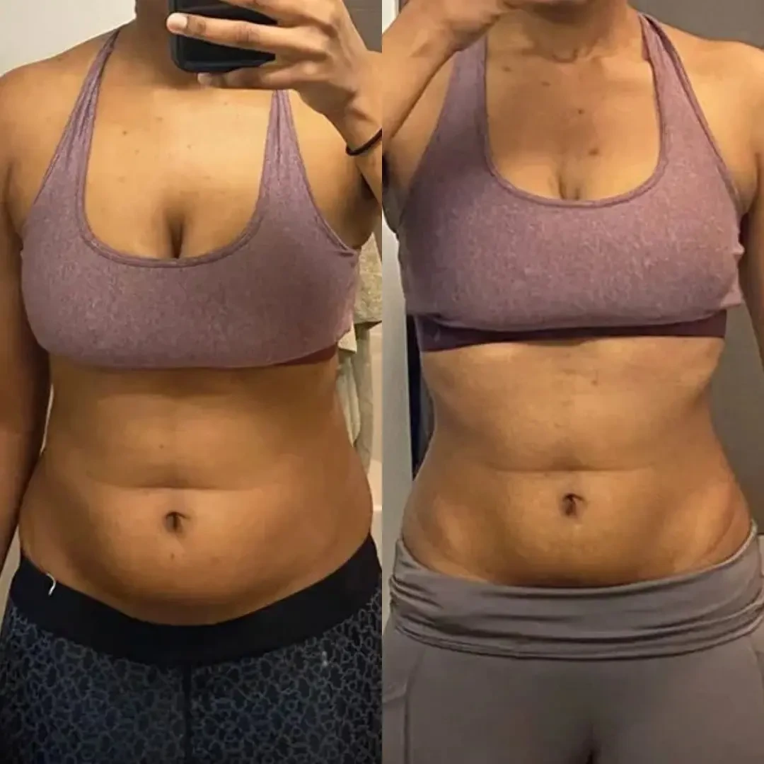 Sonicfit™ Ultrasonic Cavitation